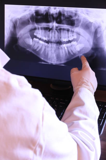 Best Emergency TMJ Treatment in Boswell, PA